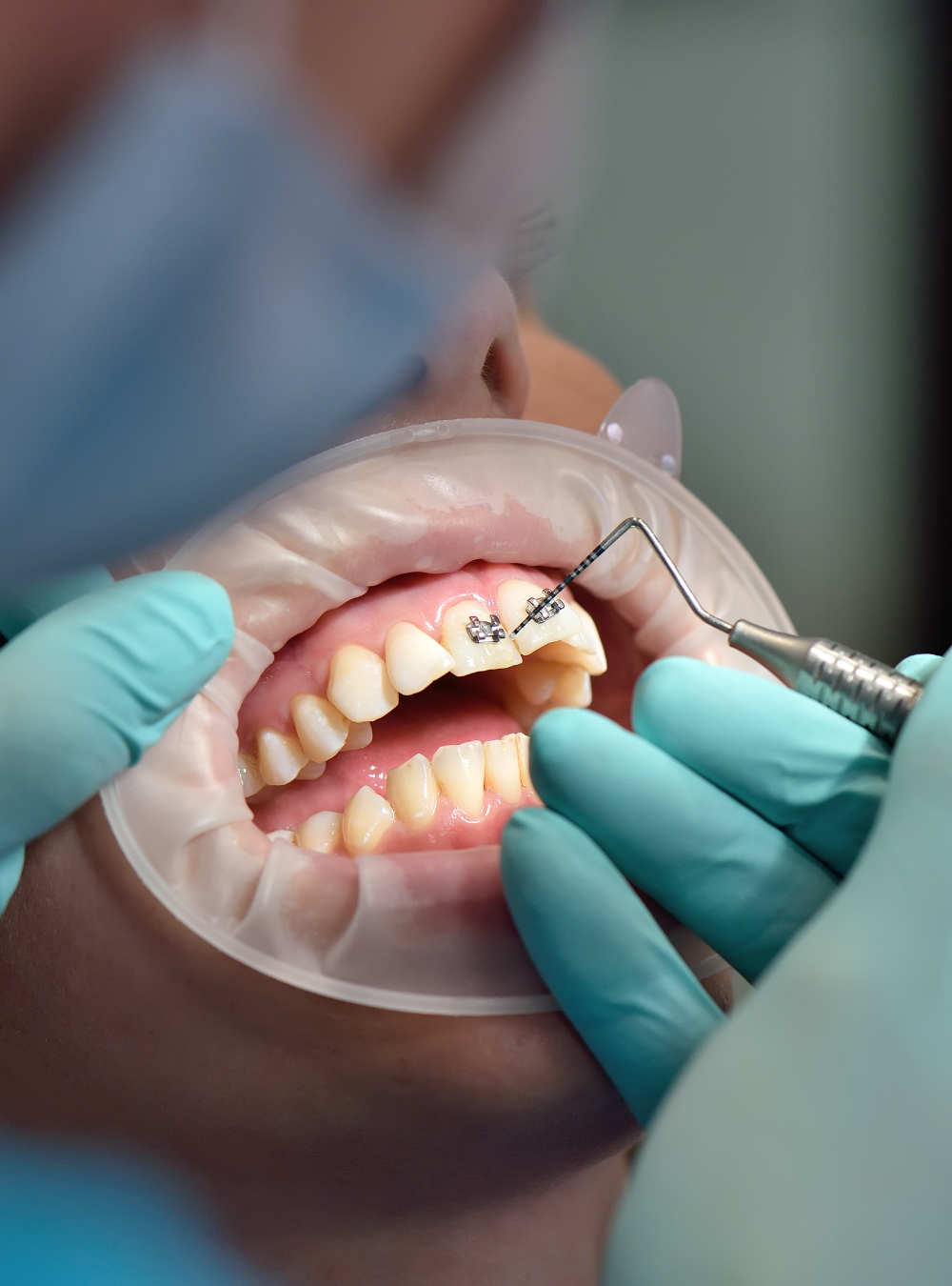 Happy Patient